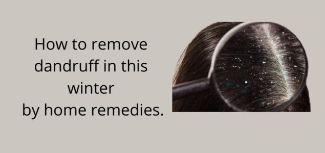 How to remove dandruff in this winter by home remedies